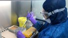 La regió sanitària de Girona ha processat més de 32.000 proves de PCR per detectar la Covid-19 
