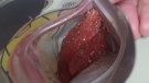 Els Mossos d’Esquadra detenen un home a Ripoll per tràfic de drogues i intervenen 100 pastilles de MDMA