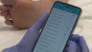 L'Hospital de Campdevànol estrena una app per al seguiment d'úlceres